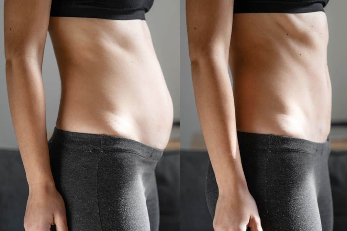 Post-Pregnancy: What Happens to Your Abdominal Muscles After Birth South Shields