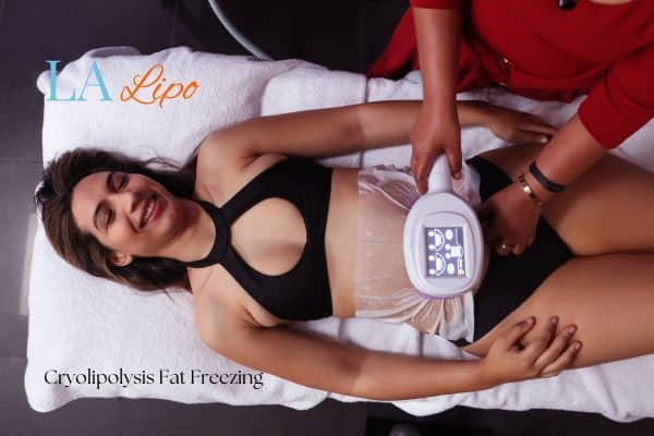 woman getting cryolipolysis South Shields