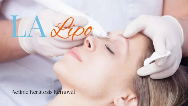 Woman receiving Actinic Keratosis Removal Treatment South Shields