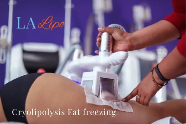 women getting fat freezing South Shields