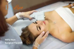 Woman having Hi-Fu to reduce wrinkles South Shields.