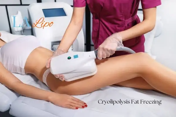 Woman receiving coolsculpting South Shields treatment on her thighs