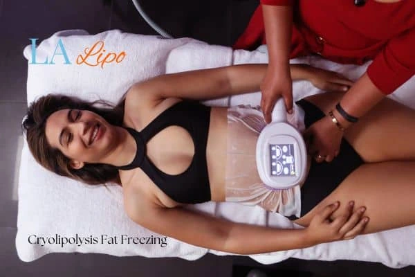 woman getting cryolipolysis South Shields