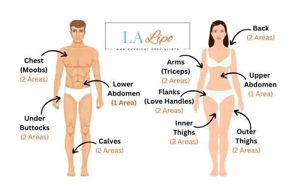 LA LIPO Cryolipolysis Areas South Shields