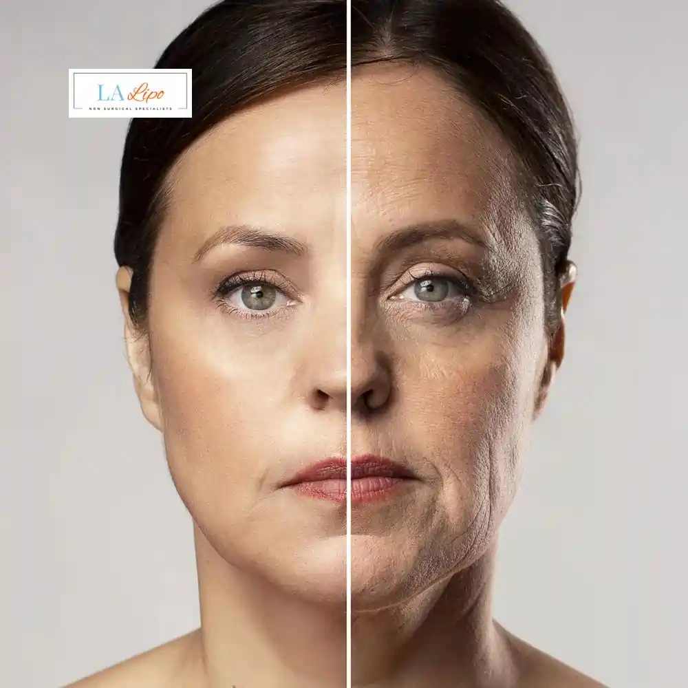 How Can You Tell If Non-Surgical Skin Tightening Is Right for You South Shields?