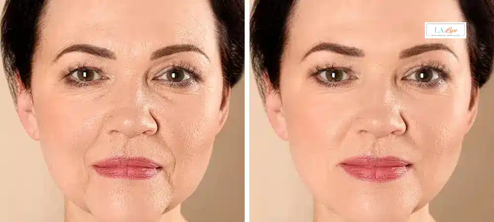 How Long Does It Take to See Results and How Long Do They Last South Shields?