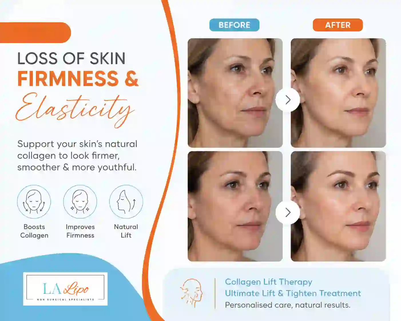 Sign #7: Loss of Skin Firmness and Elasticity South Shields